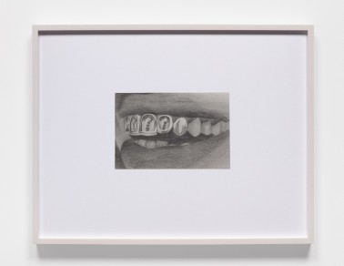 09_Custom Grillz with VVS Question Marks.jpg